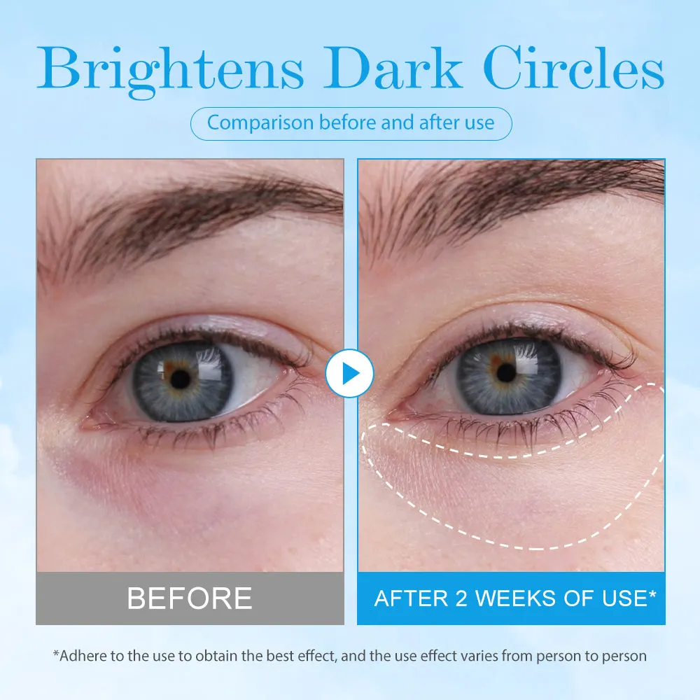 Boom Cooling Eye Gel øjengel 15g kølende mod hævelse
