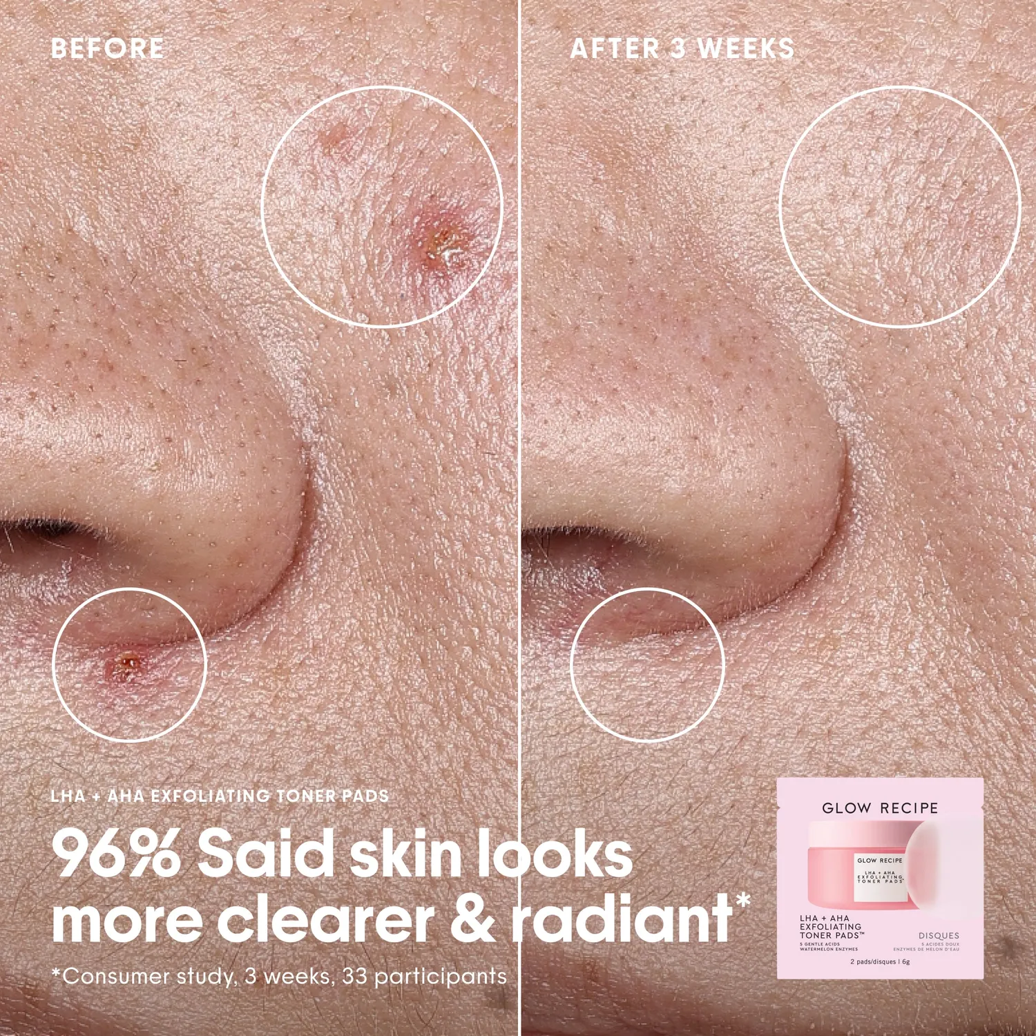 Glow Recipe Toner Pad sæt 12 breve eksfolierende
