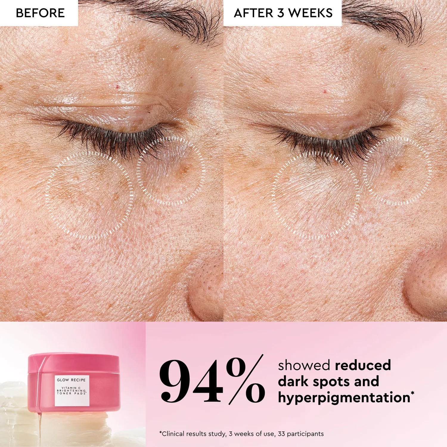 Glow Recipe Korean Toner Pad Trial Set pads 12 stk lys
