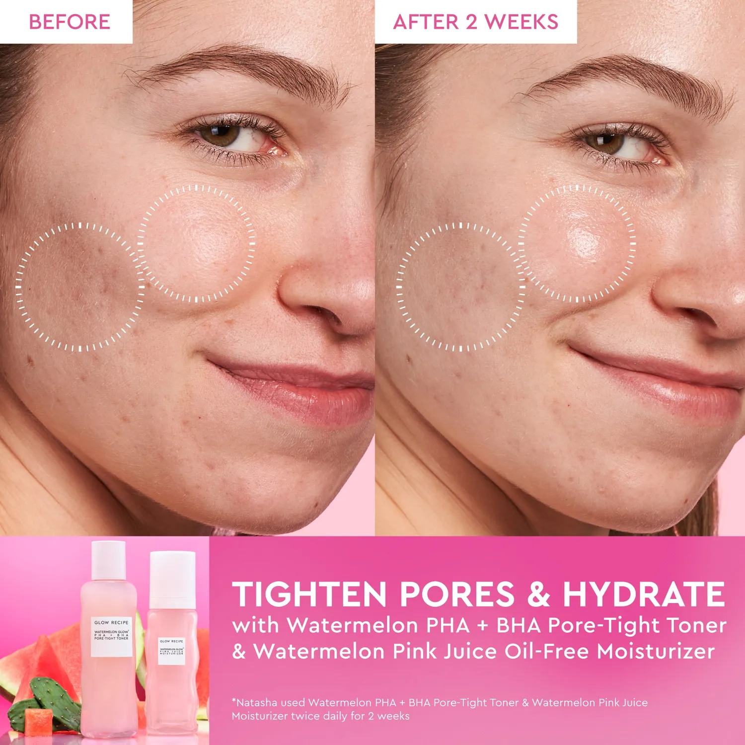 Glow Recipe Watermelon Glow Dewy Skin Routine sæt 4 dele tør hud