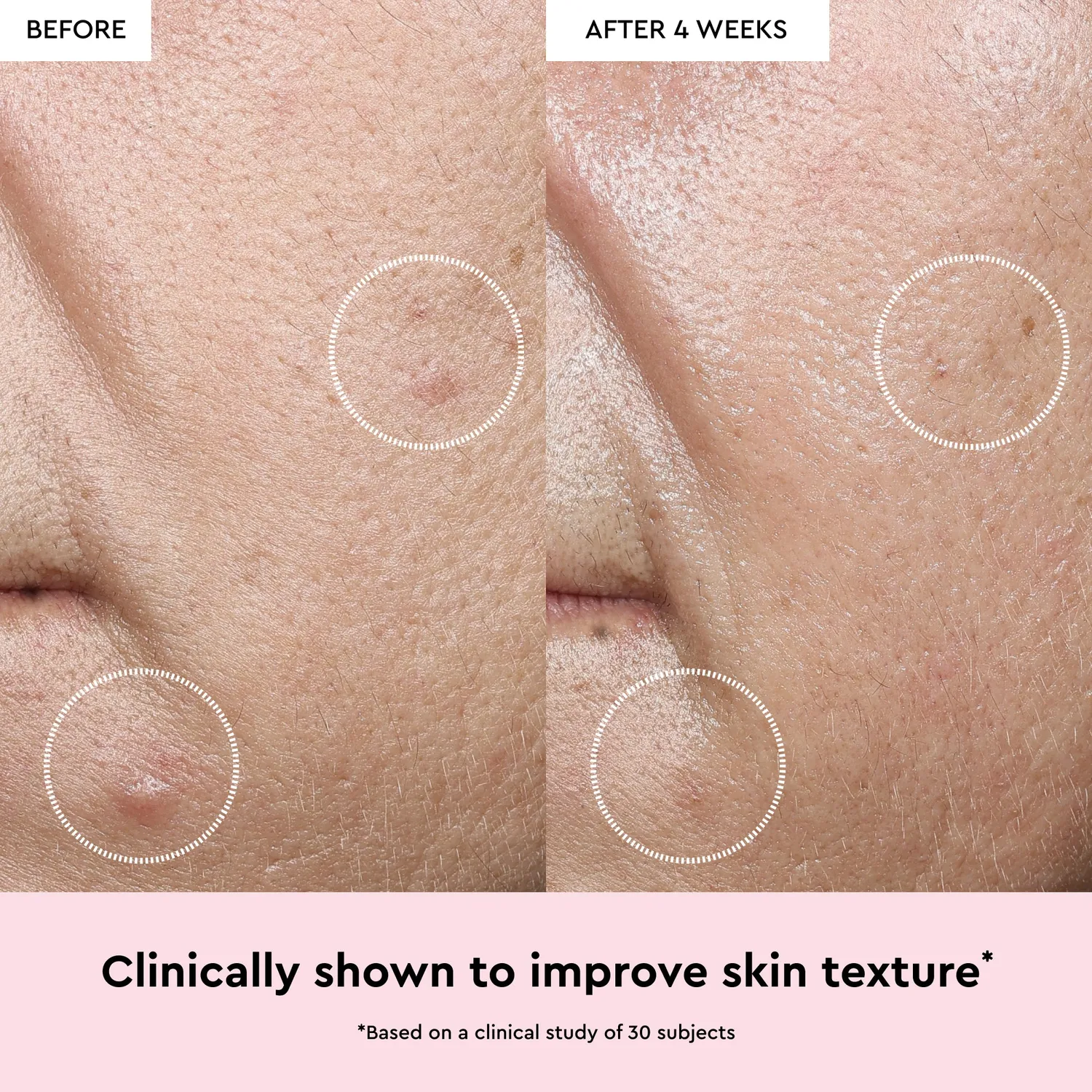 Glow Recipe Watermelon Niacinamide Dew Drops 40ml glød