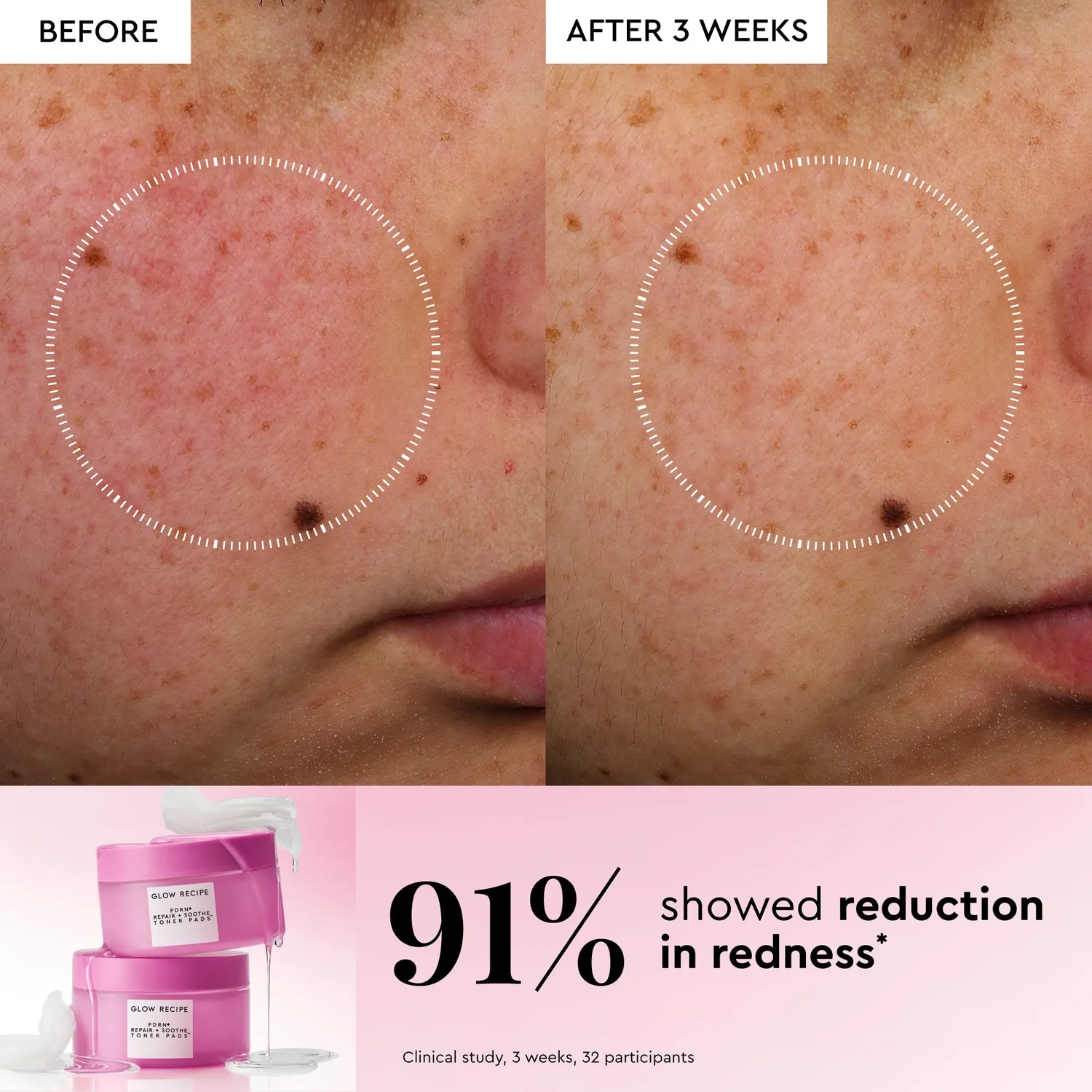 Glow Recipe Korean Toner Pad Trial Travel pads 15 stk mild