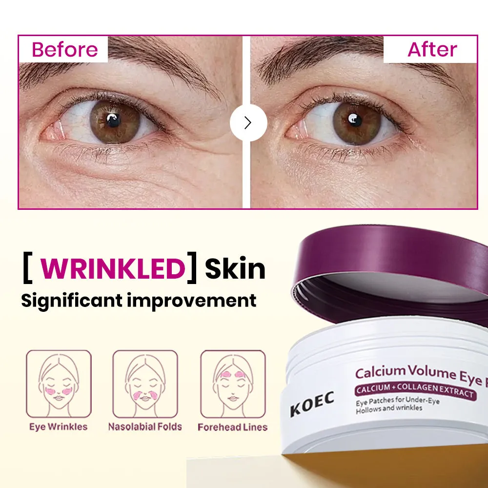 KOEC Calcium Volume øjenpatches 60 stk calcium