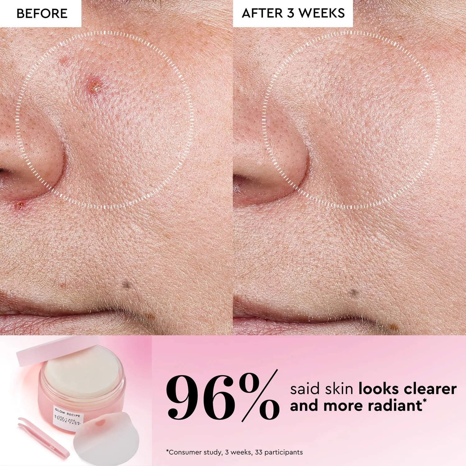 Glow Recipe Watermelon LHA + AHA toner pads 60 stk mild