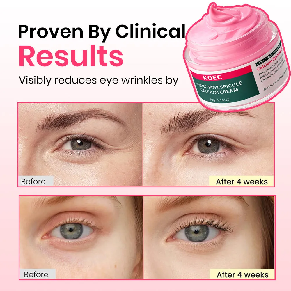 KOEC Pink Spicule Calcium øjencreme vitamin B12