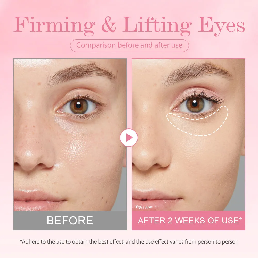 KOEC Boom Lifting Collagen øjengel 1 stk kølende