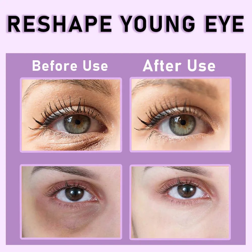 KOEC Retinol Firming øjencreme mod rynker