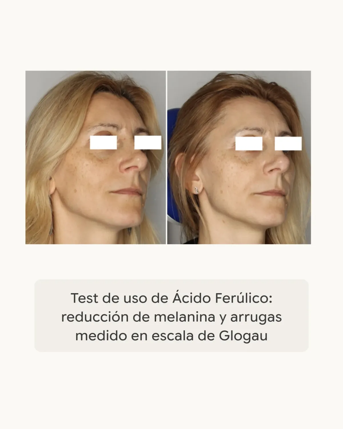 Dhyvana Veggie Boost Serum mimiklinjer