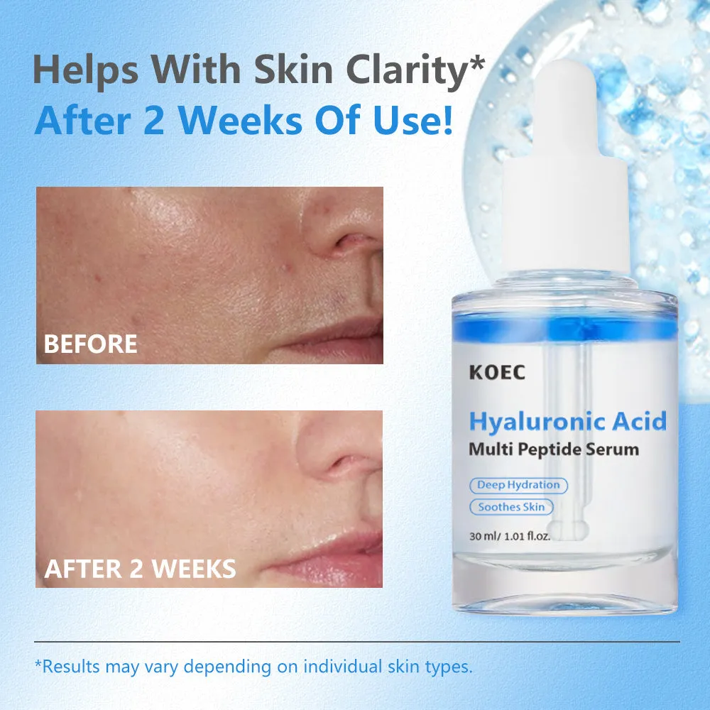 KOEC Hyaluronic Multi Peptide PDRN Serum til tør hud
