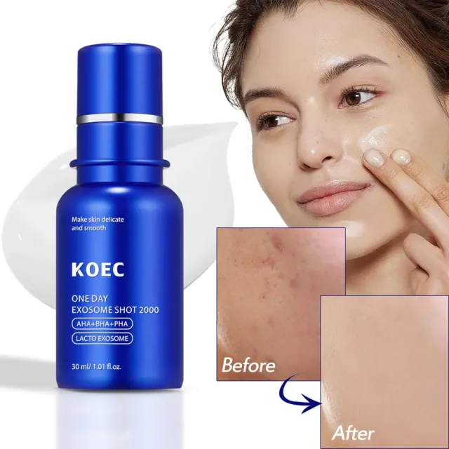KOEC One Day Exosome Shot 2000 ansigtsserum porer