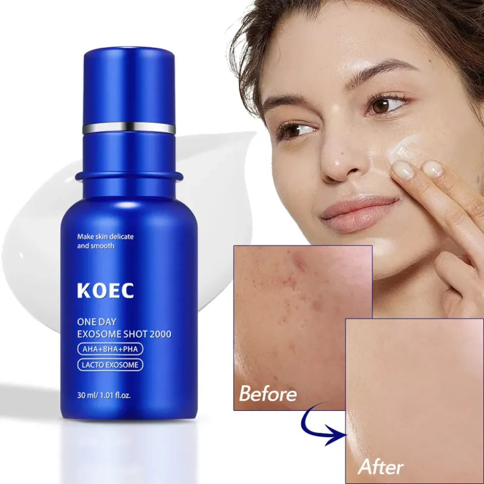 KOEC One Day Exosome Shot 2000 ansigtsserum porer