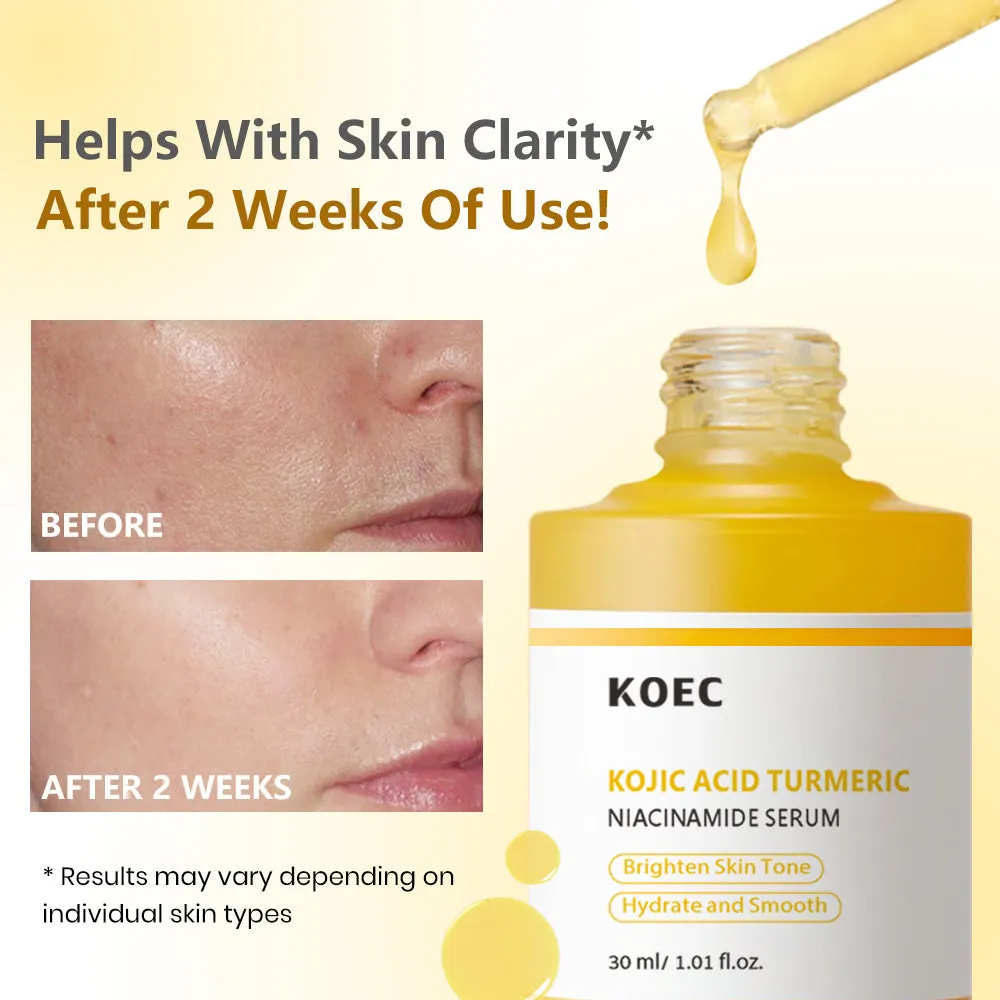 KOEC Kojic Acid Turmeric Niacinamide serum mod pigmentpletter