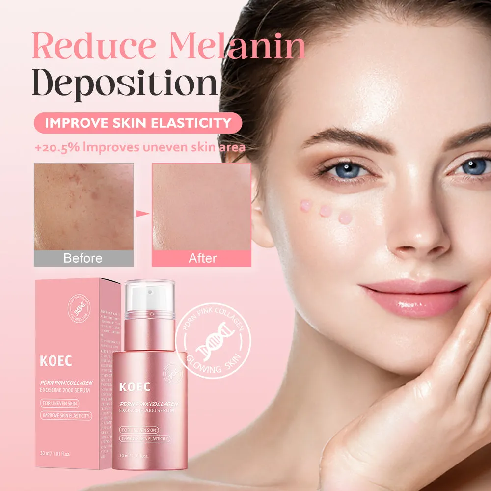 KOEC Pinke PDRN Collagen Exsome 2000 serum 1 stk til glød