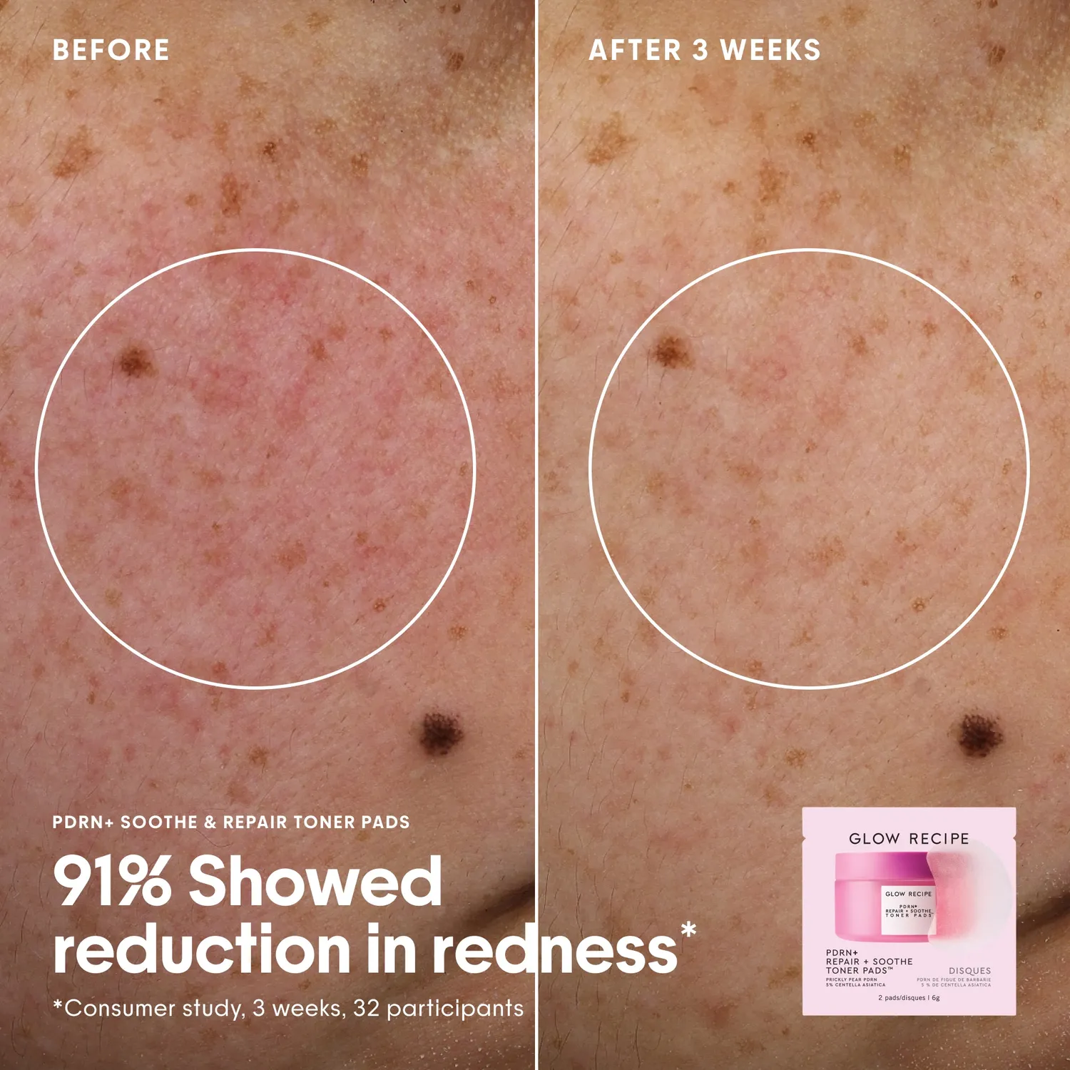 Glow Recipe Toner Pad sæt 12 breve eksfolierende