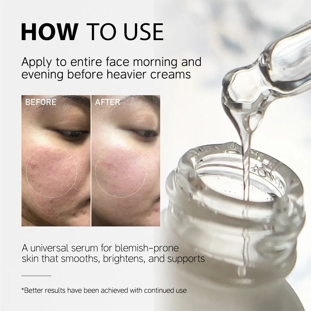 KOEC Niacinamide 10%+Zinc 1% Face Serum ansigtsserum