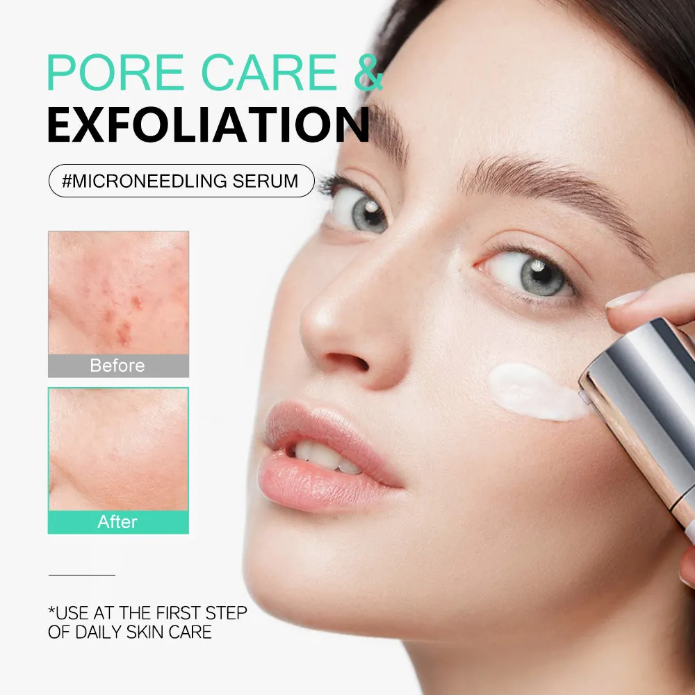 KOEC Cica Centella Microneedle serum 50 ml prikkende