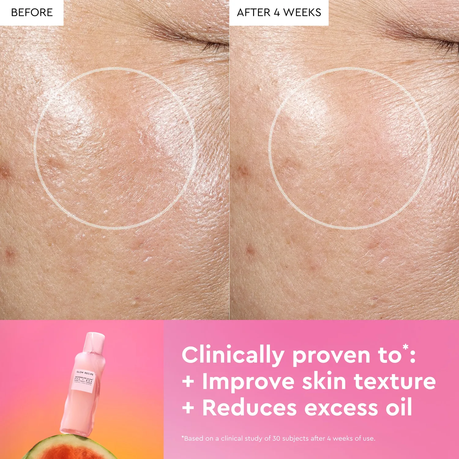 Glow Recipe Watermelon Glow PHA+BHA Toner 150ml til porer